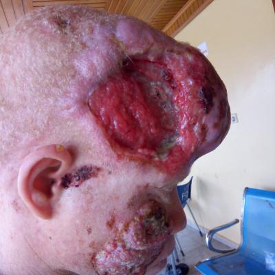 Restore Mission In Ghana 2017 2 20171017 2066808553