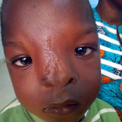 Restore Mission in Ghana 2017